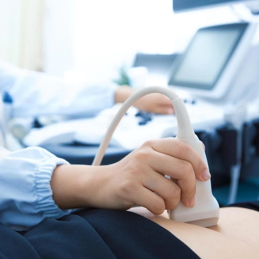 Monitoreo fetal a domicilio